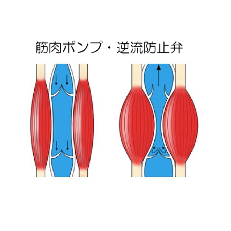 下肢静脈瘤